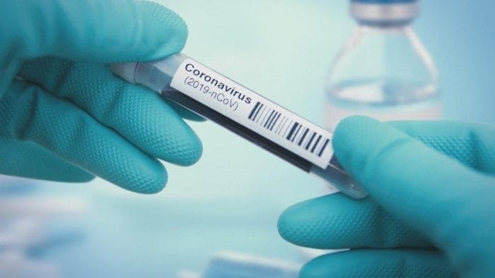 Pesquisa da FVS desmente pesquisador e mostra queda de 39% em óbitos por Covid-19 em Manaus