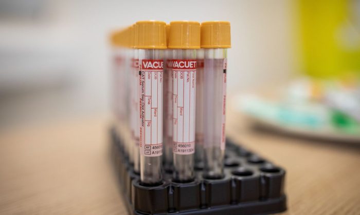 Amazonas registra 798 novos infectados por Covid-19 em 24 horas, diz FVS