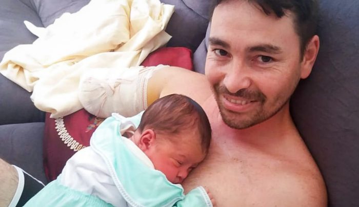 Homem perde braços em acidente e faz ‘vaquinha’ para comprar próteses e poder carregar filho