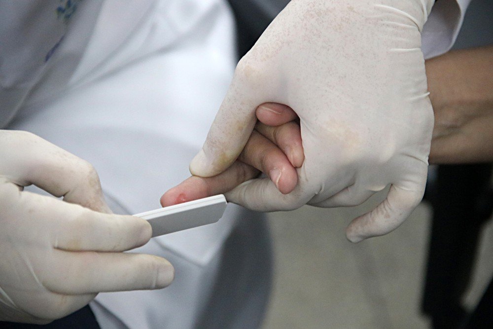 Amazonas chega a 183.830 casos de Covid-19 e 15 municípios deixam de informar dados à FVS