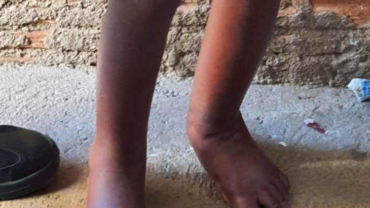 Criança resgatada após sofrer tortura em Campinas (Reprodução/Polícia Militar de SP)