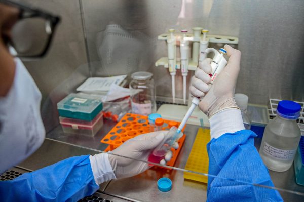 Em pesquisa inédita, Fiocruz RO vai analisar efeitos da vacinação contra a Covid-19 com imunizantes diferentes