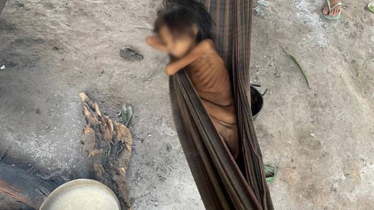Foto de menina Yanomami, de 8 anos, deitada em uma rede com as costelas expostas chamou a atenção para a crise humanitária dos Yanomami (Reprodução/Folha de S. Paulo)