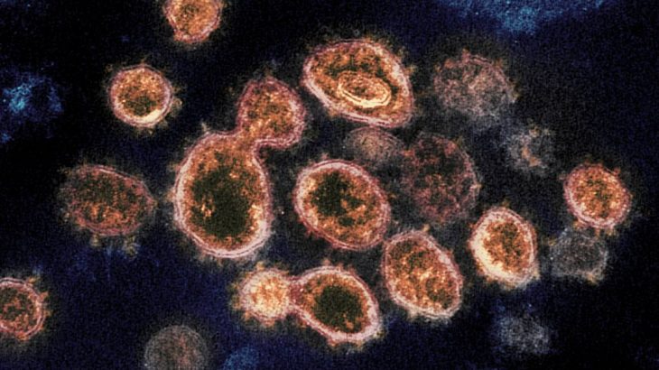 Coronavírus vistos por um microscópio eletrônico. (NIAID/NIH)