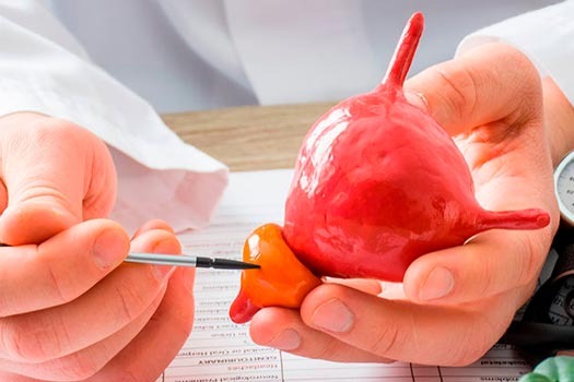 Alerta: 25% dos homens entre 40 a 49 anos podem ter o aumento benigno da próstata no País