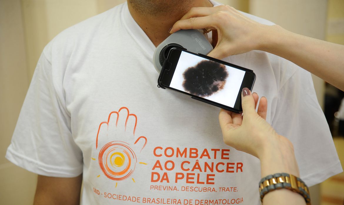 Pacientes são examinados durante campanha do Dia Nacional de Combate ao Câncer de Pele no Hospital Federal de Ipanema (Fernando Frazão/Agência Brasil)