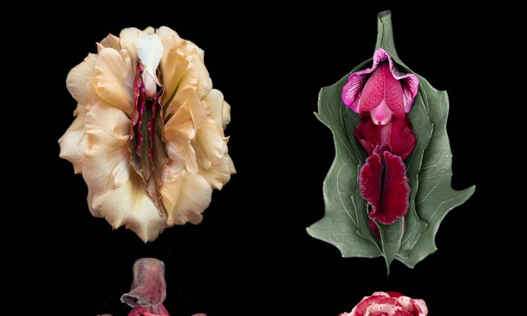 Botox, peeling e laser: as novas tendências de tratamento para a genitália feminina