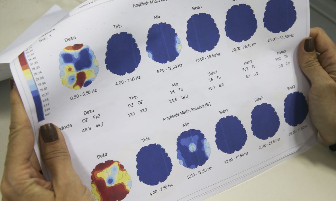 Março Roxo: campanha quer conscientizar população sobre a epilepsia