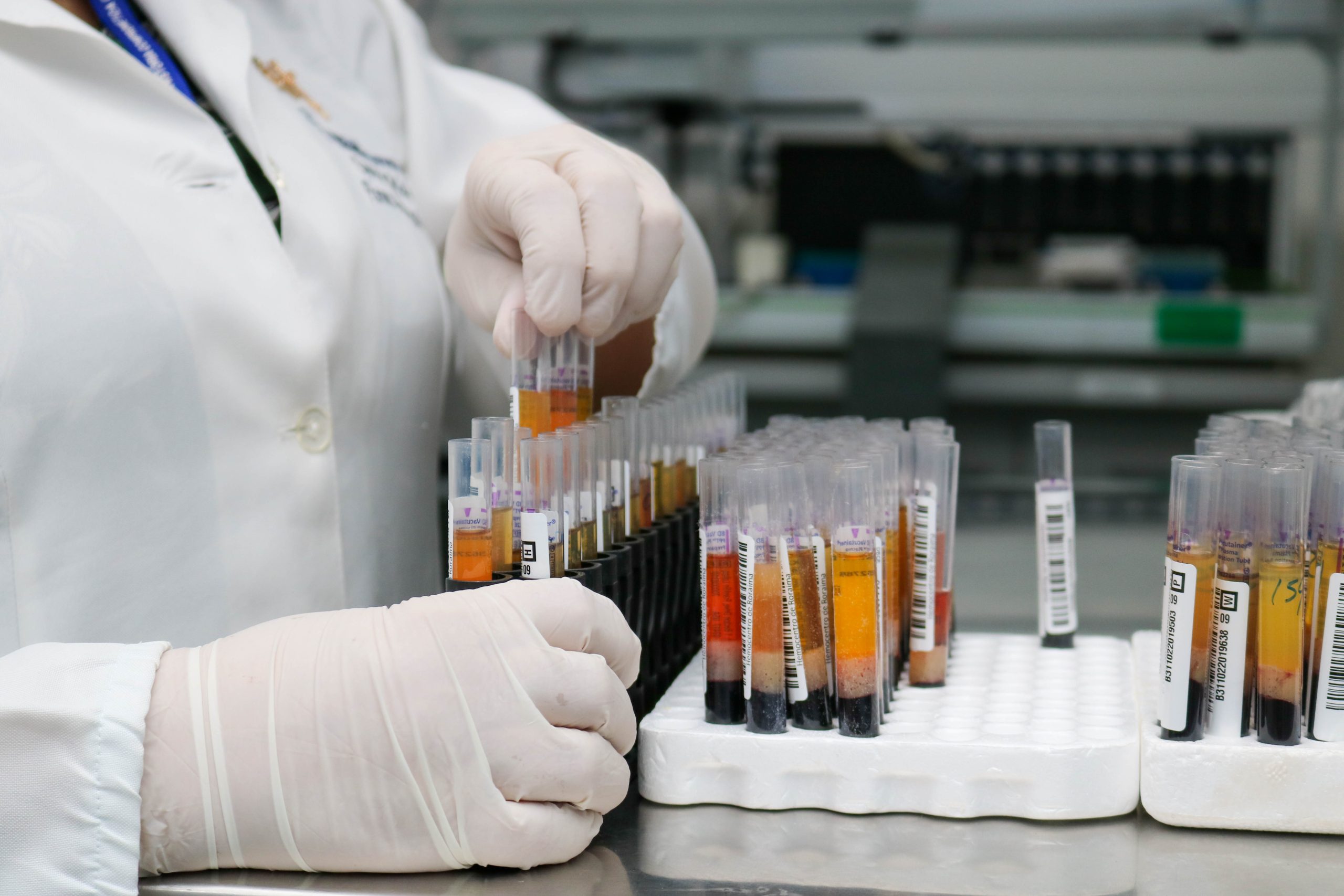 Projeto pioneiro no Brasil realizará testes de malária em doadores do Hemoam a partir de junho