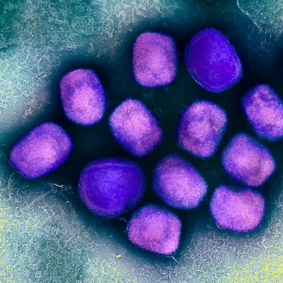 Paciente brasileiro diagnosticado com varíola dos macacos na Alemanha tem alta