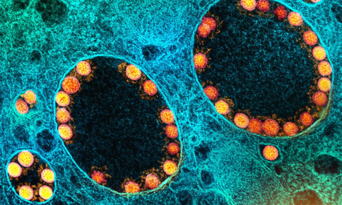 Estudo conduzido pela Fiocruz Minas Gerais mostra eficácia da vitamina B12 para atenuar Covid-19