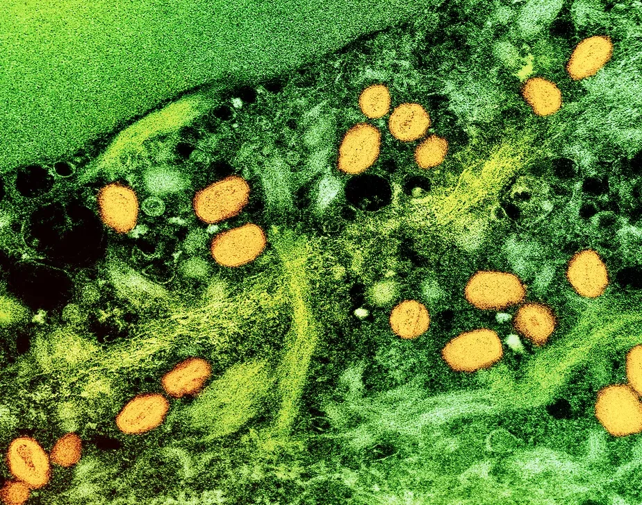 Estudo revela que vírus da varíola dos macacos sobrevive em superfícies por ao menos 30 dias
