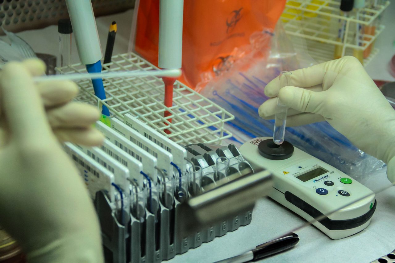 Vigilância Sanitária confirma primeiros casos de Monkeypox no Estado de Rondônia