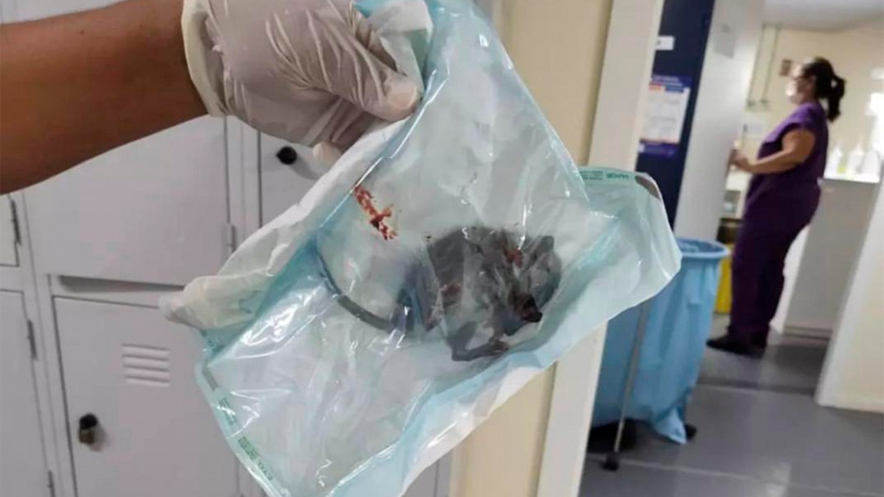 Em Roraima, servidores de maternidade encontram rato em unidade improvisada com tendas e lonas