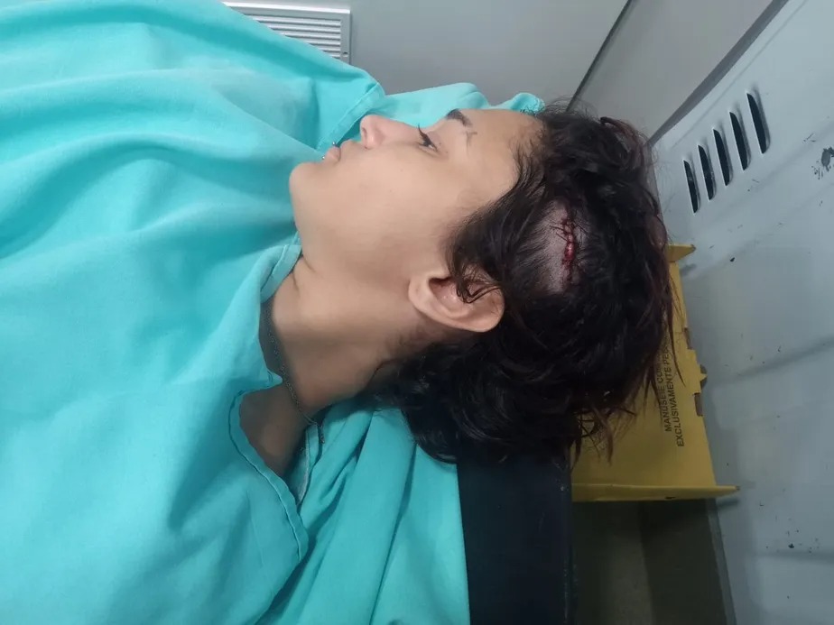 Mulher é agredida na cabeça com madeira após criticar Bolsonaro em bar: ‘Vai apanhar que nem homem’