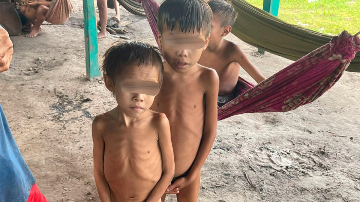 Diarreia, pneumonia e desnutrição matam mais crianças pretas e indígenas do que as brancas, revela estudo