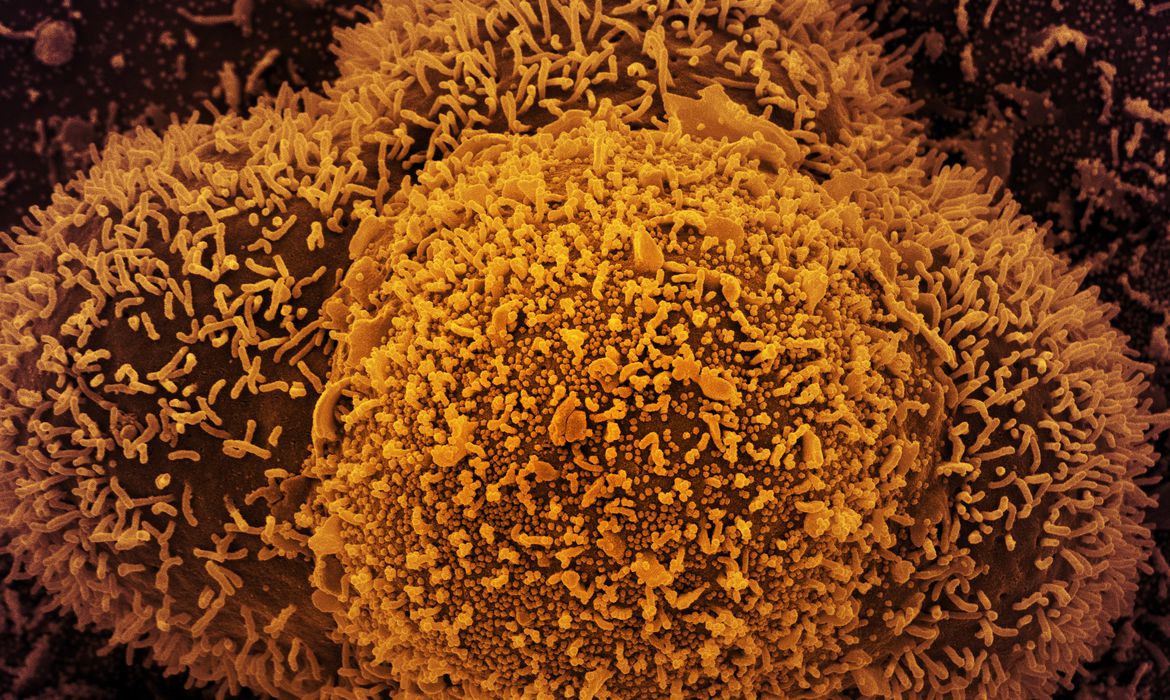 Brasileiros infectados com Covid-19 passa de 34,9 milhões e média móvel de casos aumenta 63%