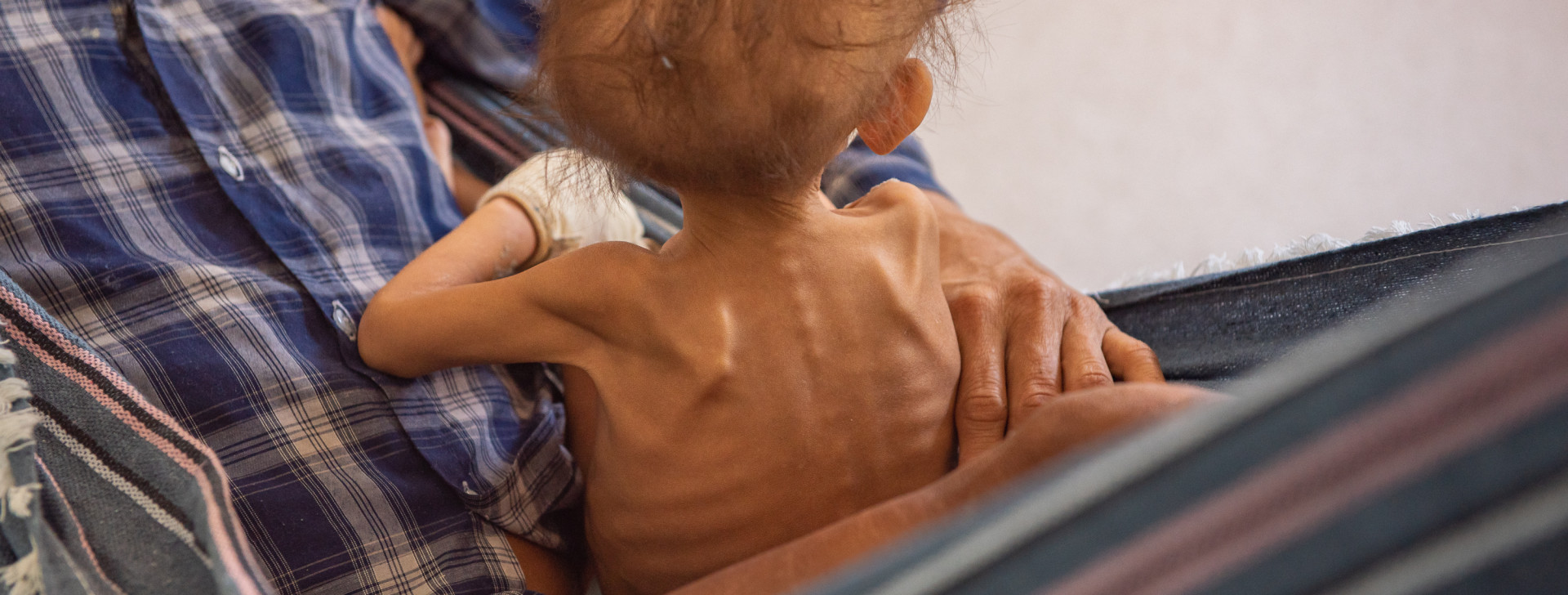 More than 50 Yanomami children are in a children’s hospital in Boa Vista; 7 are in intensive care