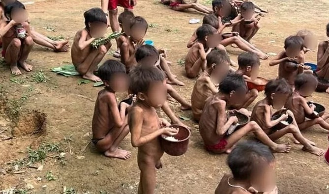 Crianças Yanomami desnutridas pela inação do governo e a ação de garimpeiros
(Reprodução/Urihi Associação Yanomami)