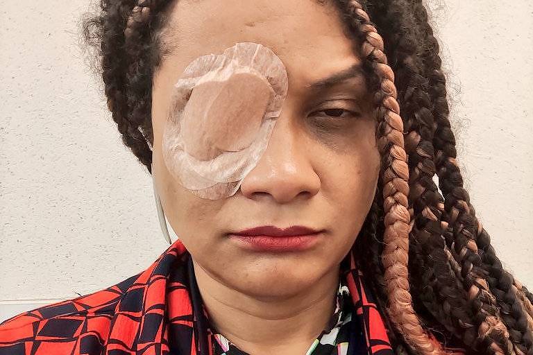 Anvisa proíbe venda e uso de todas as pomadas para modelar e trançar cabelos