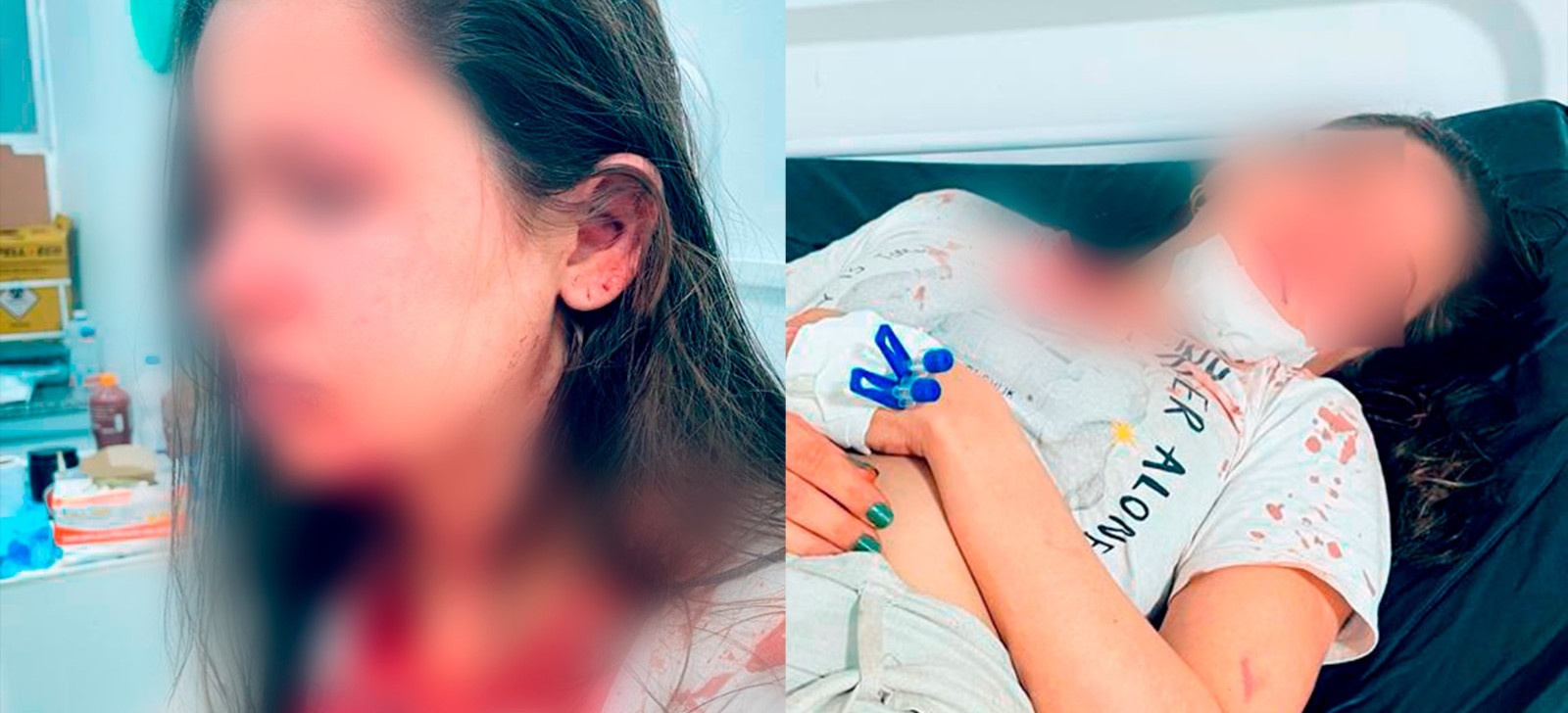 Delegado é acusado de atenuar tentativa de feminicídio; veja imagens