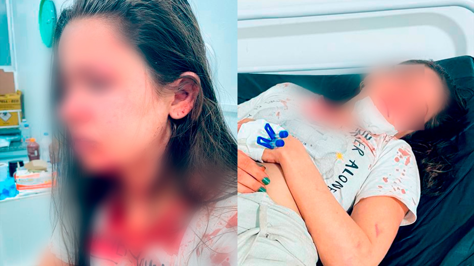 Delegado é acusado de atenuar tentativa de feminicídio; veja imagens