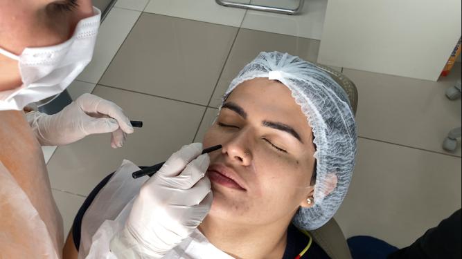 Pessoas em transição podem ter acesso exclusivo à harmonização facial no AM