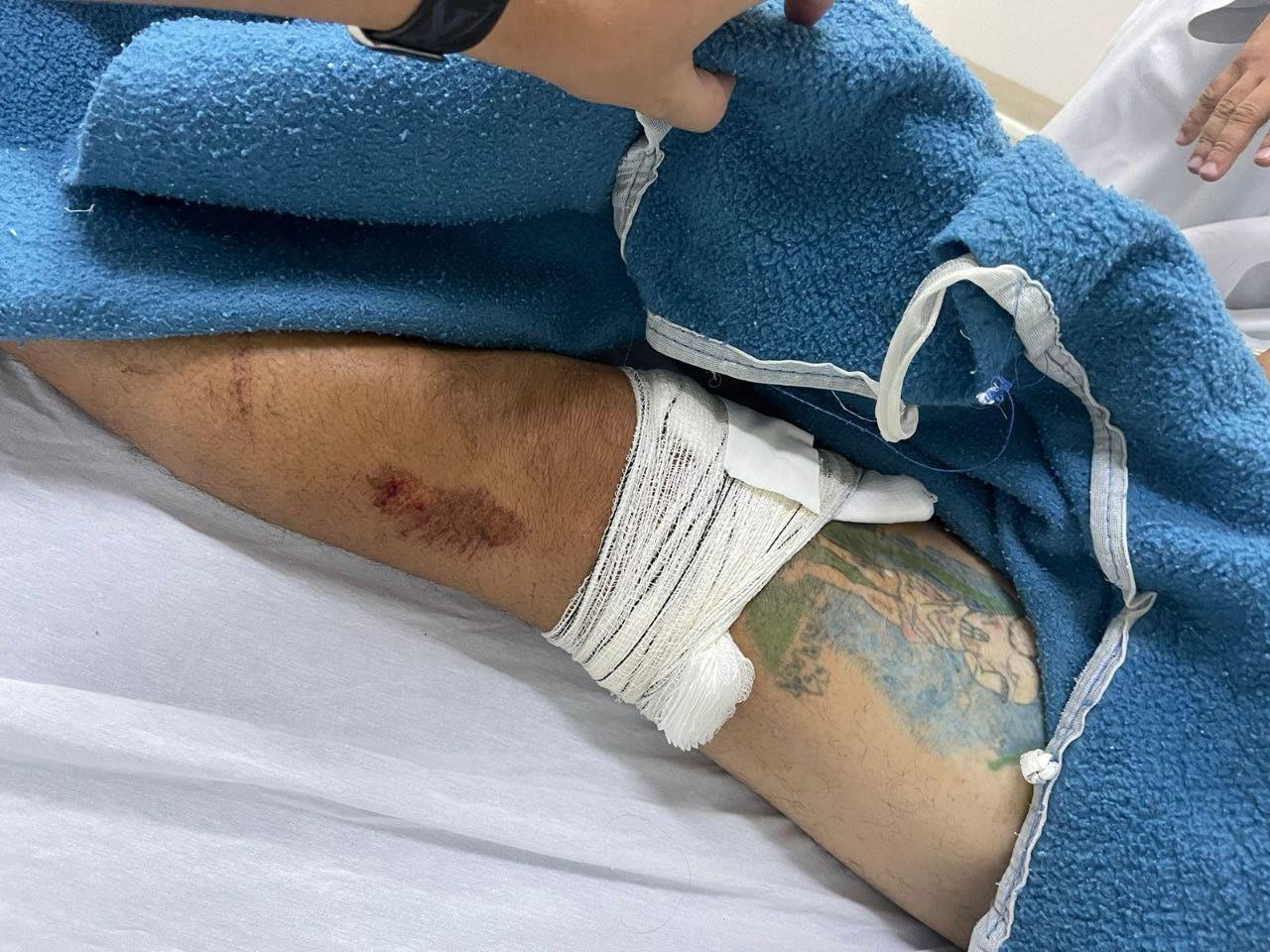 Família acusa maior hospital de RR de operar perna errada de paciente