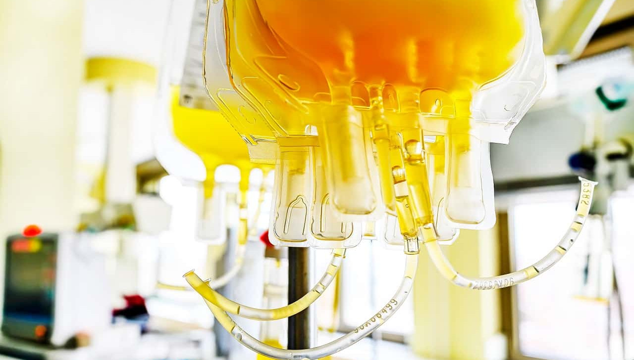 Pesquisa revela que plasma sanguíneo é alternativa de tratamento para câncer de colo de útero