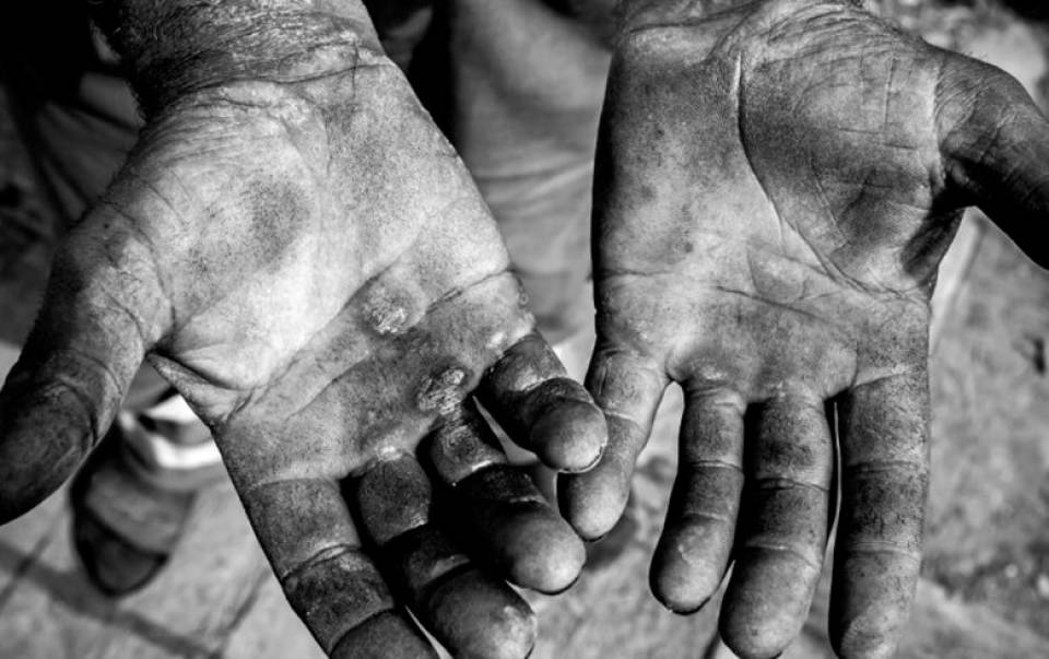 Polícia Federal investiga família no ES por manter idoso de 71 anos em trabalho escravo