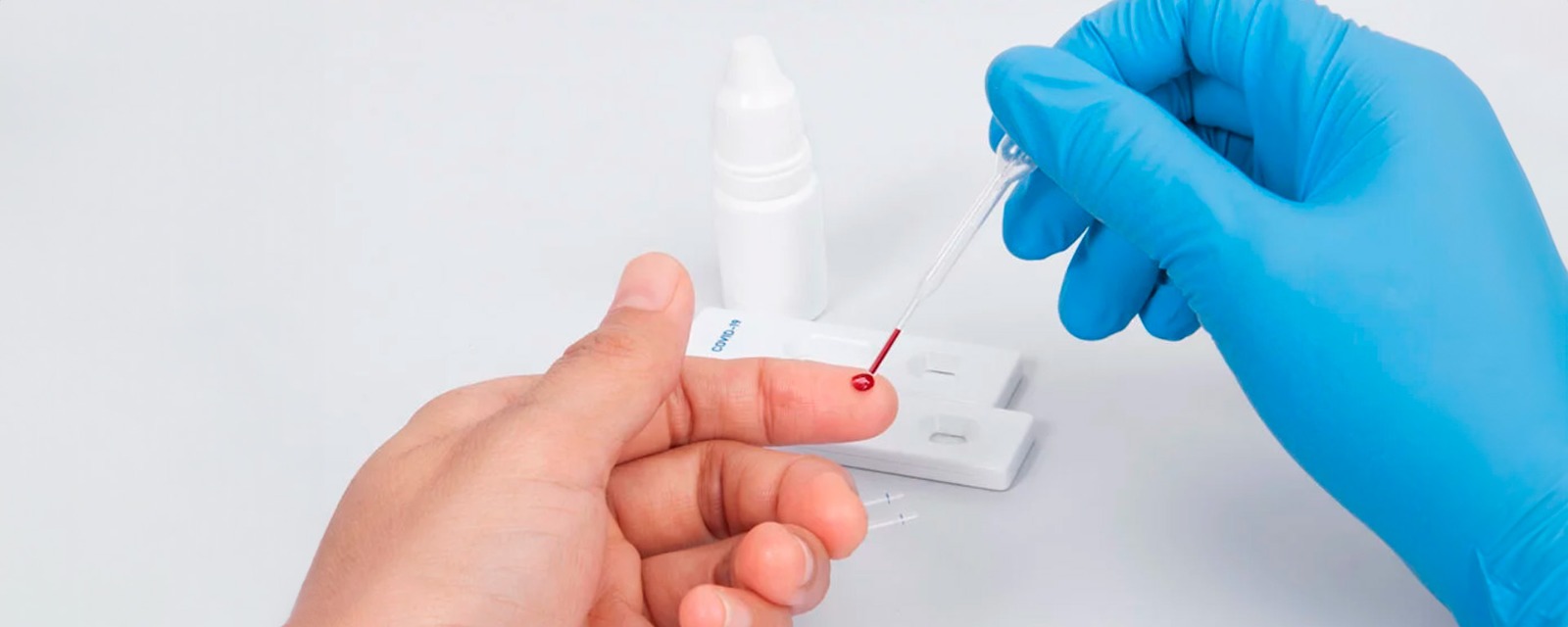 Amazonas é o segundo em casos de HIV na Região Norte