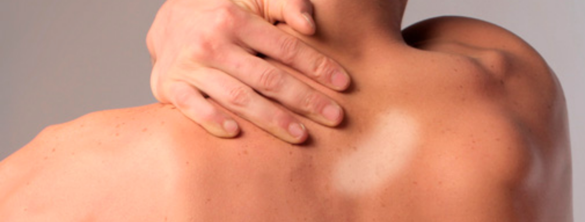 Governo federal anuncia R$ 55 milhões para prevenção e tratamento da hanseníase