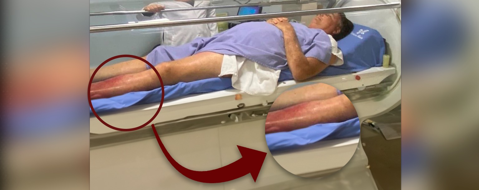 Após ficar internado em Manaus, Jair Bolsonaro deve ser transferido para Brasília