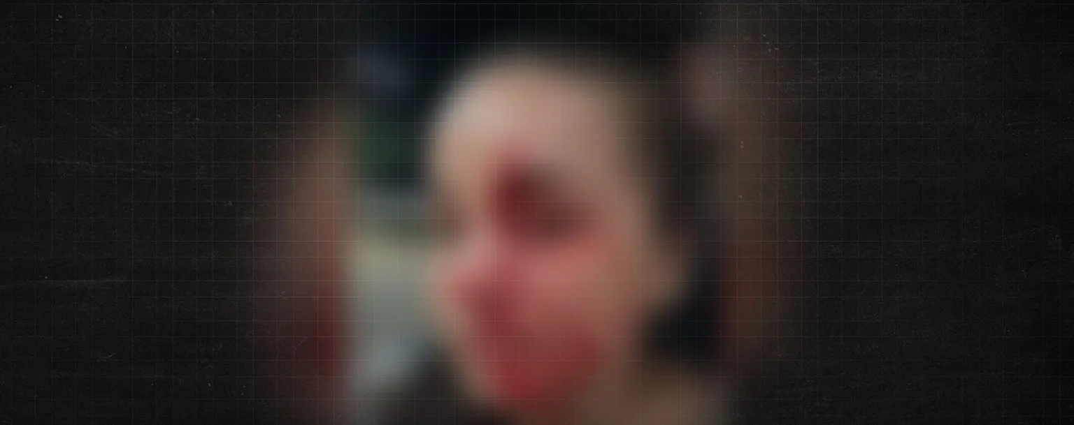 In Amazonas, investigator is dismissed after punching woman