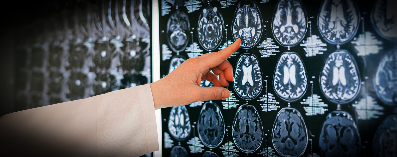 Pesquisa indica que risco de Parkinson dobra em pessoas com ansiedade após 50 anos