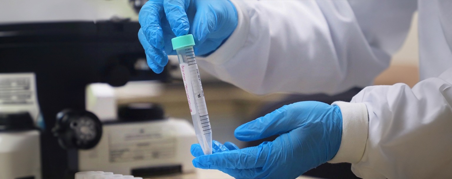 Amazonas tem 11 casos confirmados de Mpox