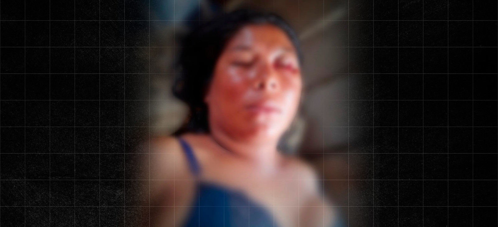 Liderança indígena agride e arranca olho de esposa no Vale do Javari, diz família