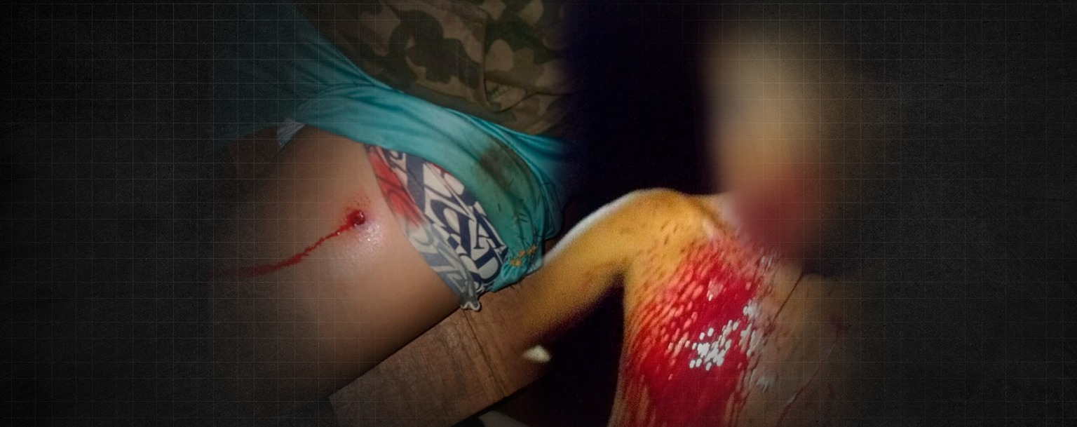 Novo ataque a indígenas Avá-Guarani deixa quatro feridos