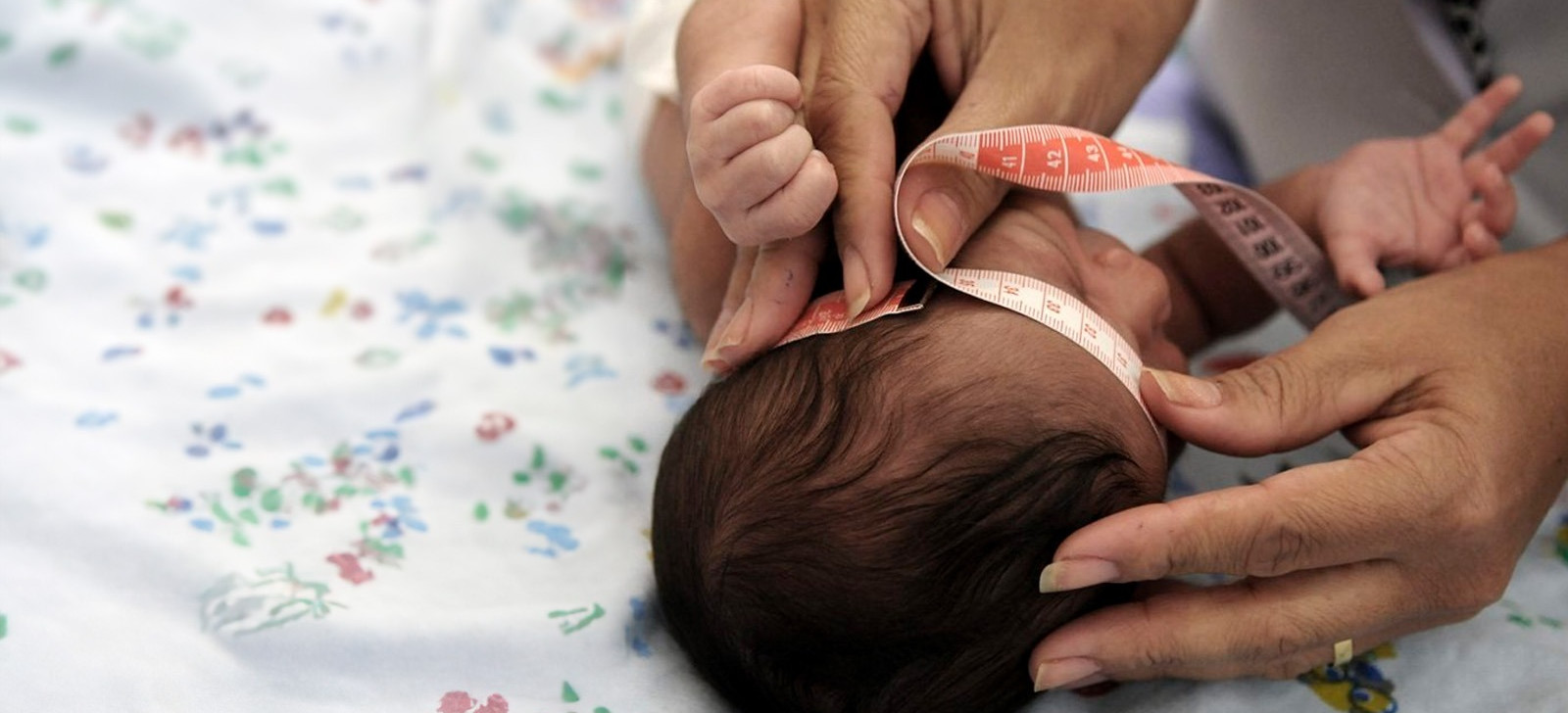 Health professional measures the head circumference of a child (Tony Winston/Agência Brasília)