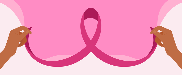 Invasive Lobular Breast Cancer: A Silent Killer