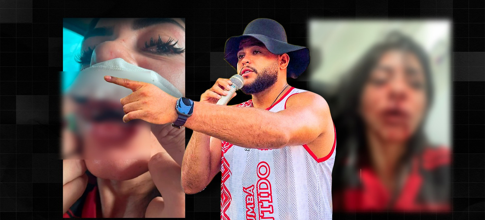 Advogada denuncia agressão de cantor contra esposa no AM: ‘Perdeu três dentes’