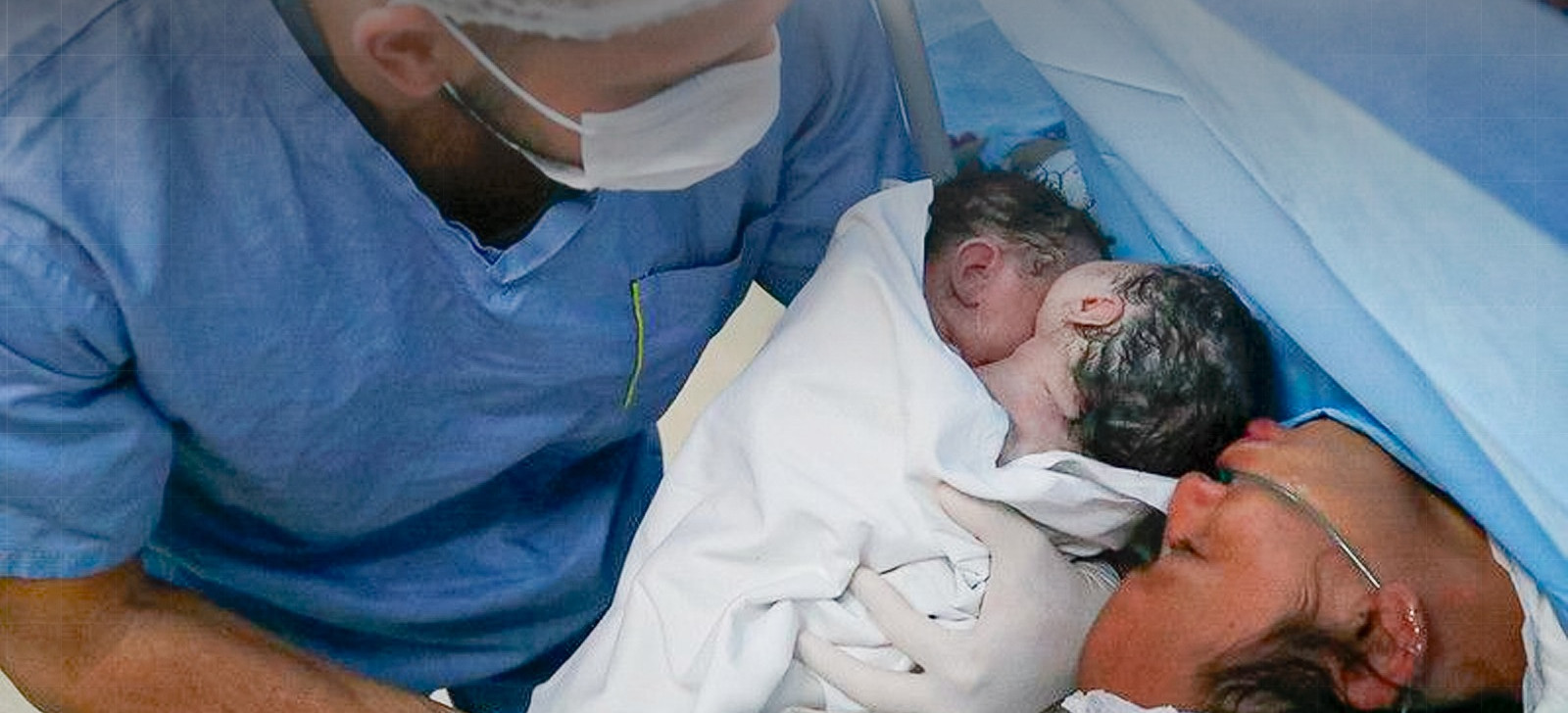 Gêmeas siamesas nascem unidas pelo abdômen em Manaus