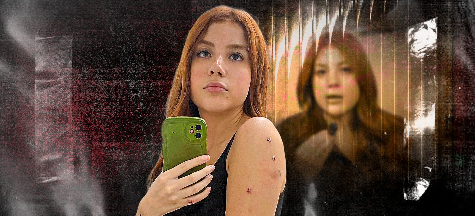 Influenciadora Laura Sabino revela que foi esfaqueada por irmão