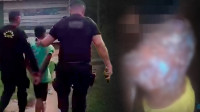 Padrasto é preso por jogar mingau quente em criança de 6 anos no AM