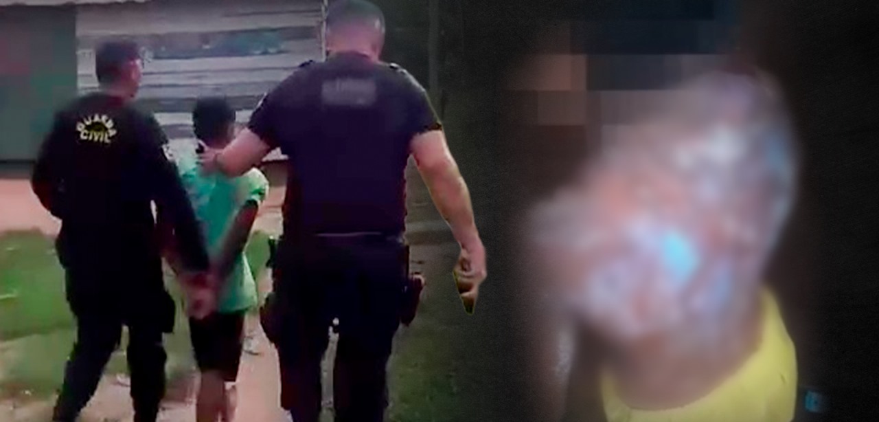 Padrasto é preso por jogar mingau quente em criança de 6 anos no AM