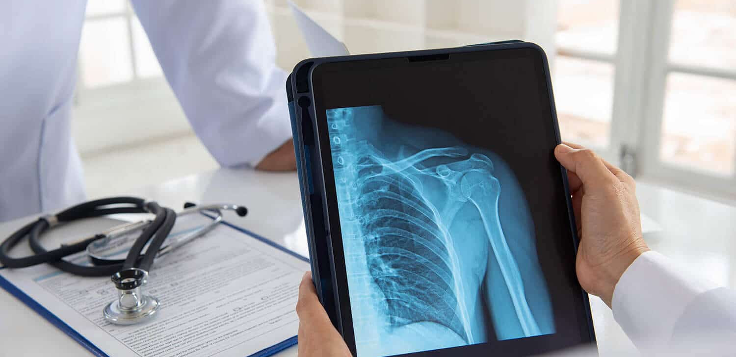 Saúde cobra devolução de R$ 6,8 milhões do Amapá por números ‘inflados’ de radiografias