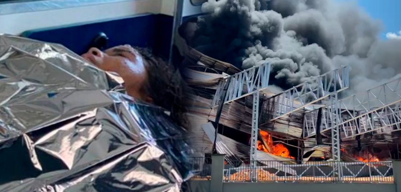 Grávida sofre queimaduras de 3º grau durante incêndio em fábrica de Manaus