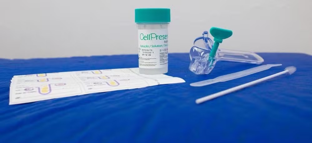 SUS adota tecnologia nacional para detectar câncer do colo do útero