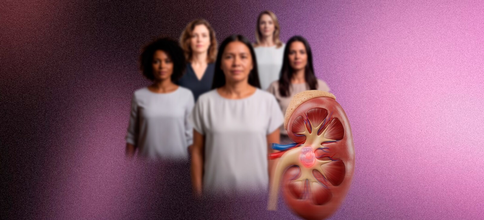 Especialista aponta avanço do câncer renal entre mulheres no Amazonas